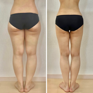 20代 OL Before/After